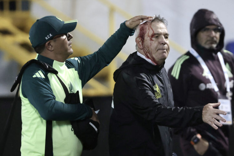 Photo by JHONY MAGALLANES/AFP via Getty Images