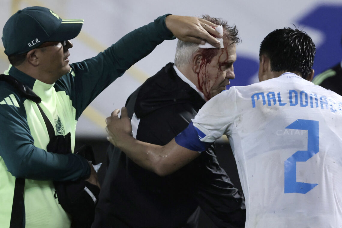 Photo by JHONY MAGALLANES/AFP via Getty Images